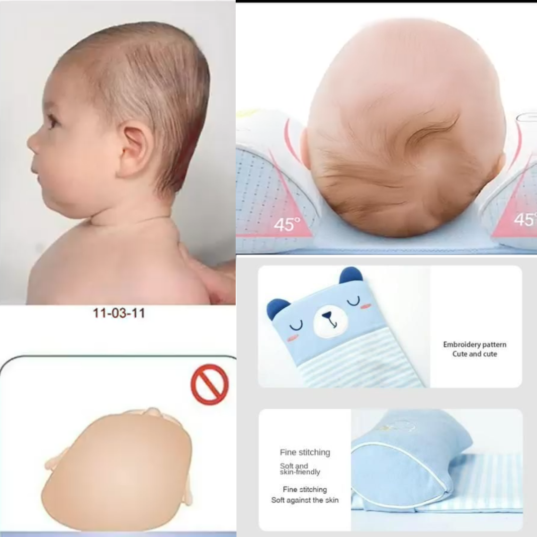 Pillow | Baby Head Support | Head Shaper